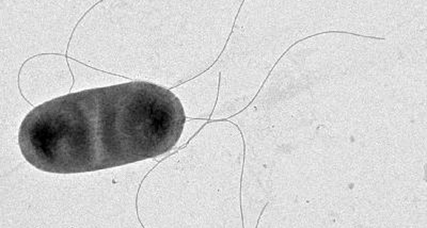 Salmonella Under the Microscope 5
